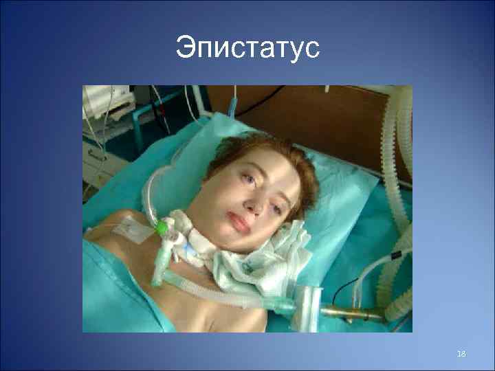 Эпистатус 18 