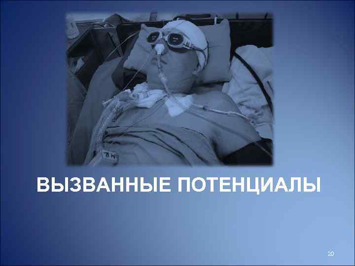 ВЫЗВАННЫЕ ПОТЕНЦИАЛЫ 20 