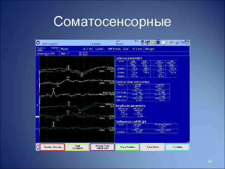 Соматосенсорные 24 