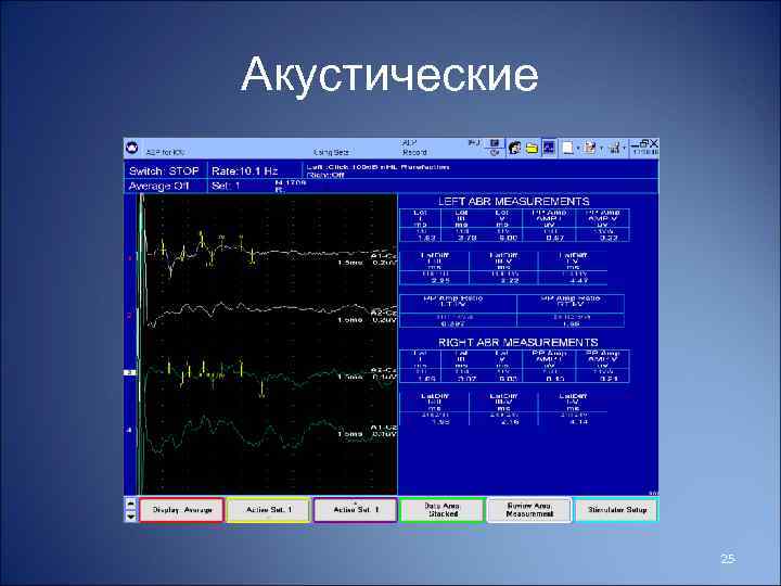 Акустические 25 