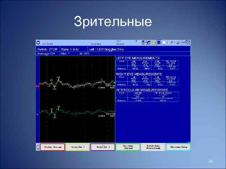 Зрительные 26 