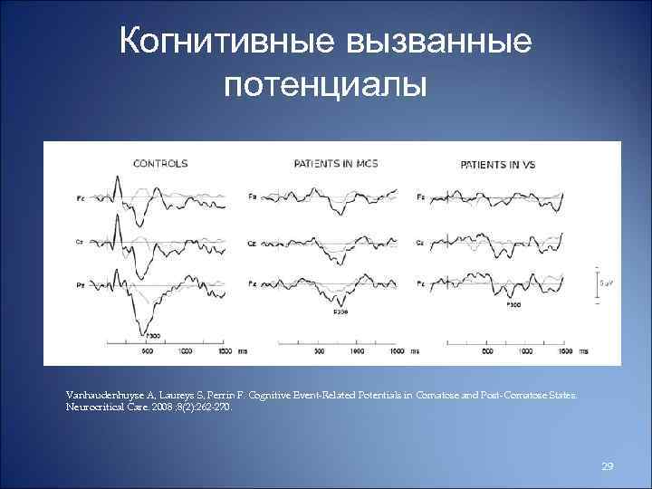 Когнитивные вызванные потенциалы Vanhaudenhuyse A, Laureys S, Perrin F. Cognitive Event-Related Potentials in Comatose