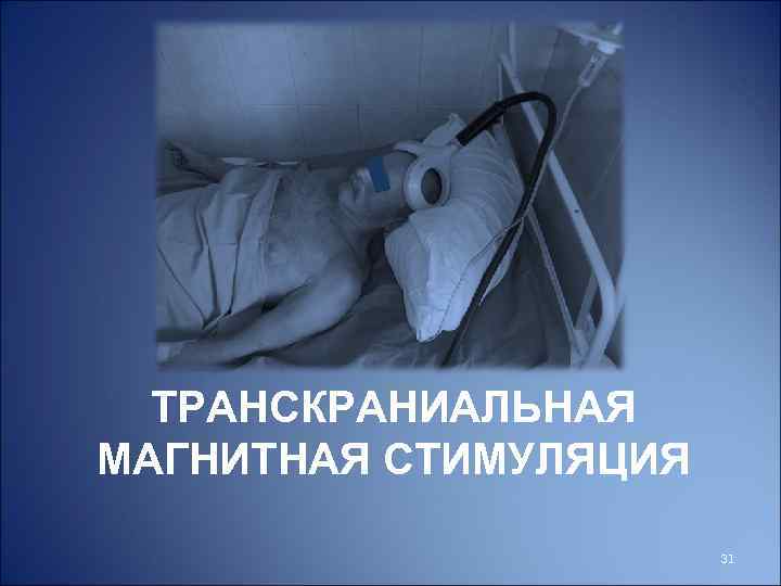 ТРАНСКРАНИАЛЬНАЯ МАГНИТНАЯ СТИМУЛЯЦИЯ 31 