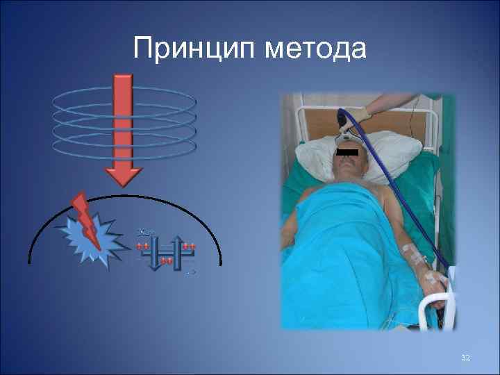 Принцип метода Na+ K+ 32 
