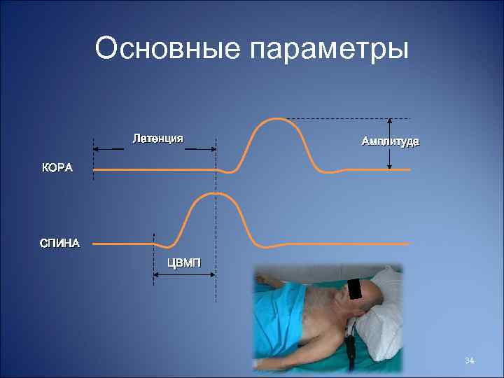 Основные параметры Латенция Амплитуда КОРА СПИНА ЦВМП 34 