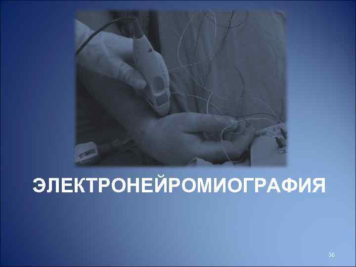 ЭЛЕКТРОНЕЙРОМИОГРАФИЯ 36 