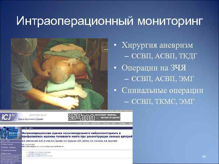 Интраоперационный мониторинг • Хирургия аневризм – ССВП, АСВП, ТКДГ • Операции на ЗЧЯ –