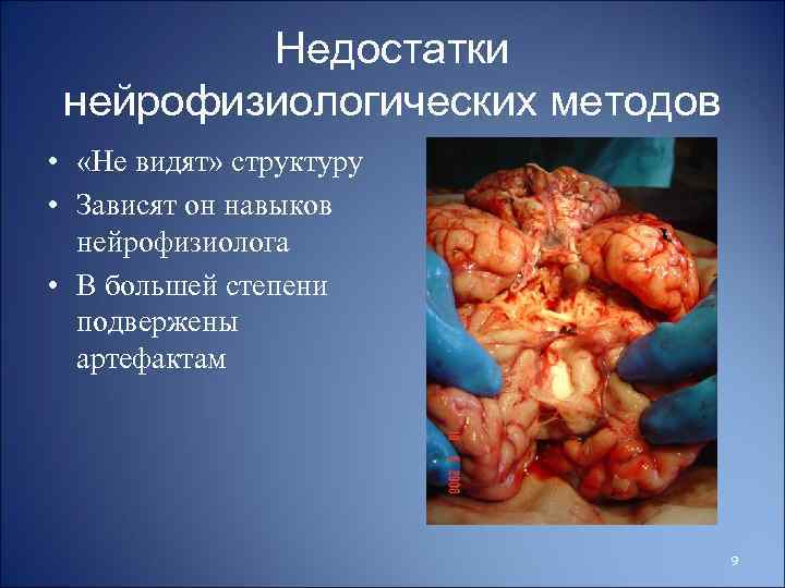 Недостатки нейрофизиологических методов • «Не видят» структуру • Зависят он навыков нейрофизиолога • В