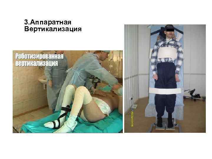 3. Аппаратная Вертикализация 