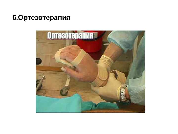 5. Ортезотерапия 