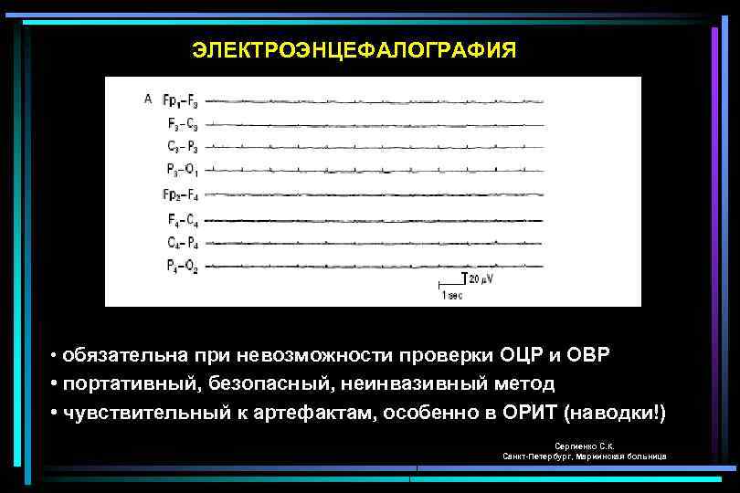 ЭЛЕКТРОЭНЦЕФАЛОГРАФИЯ • обязательна при невозможности проверки ОЦР и ОВР • портативный, безопасный, неинвазивный метод