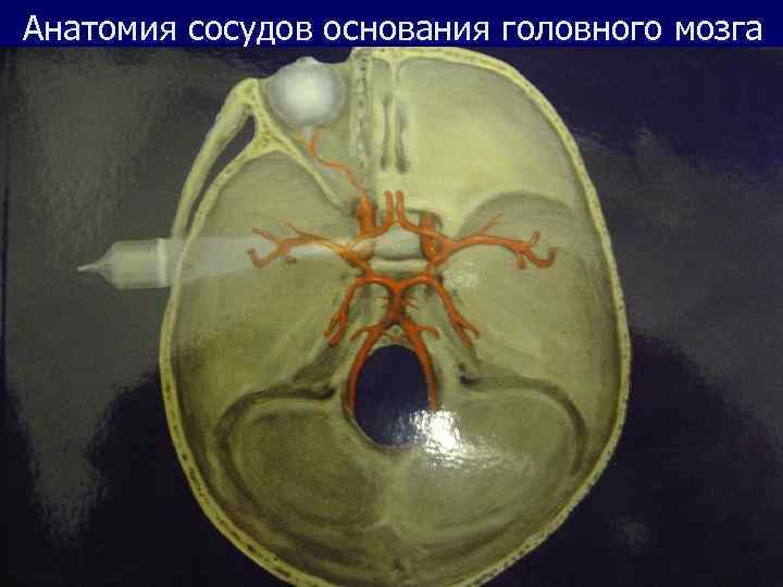 Анатомия сосудов основания головного мозга 