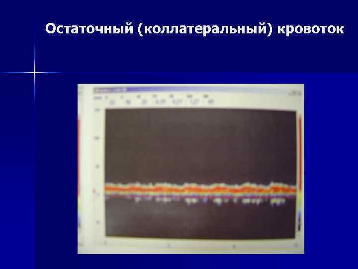 Остаточный (коллатеральный) кровоток 