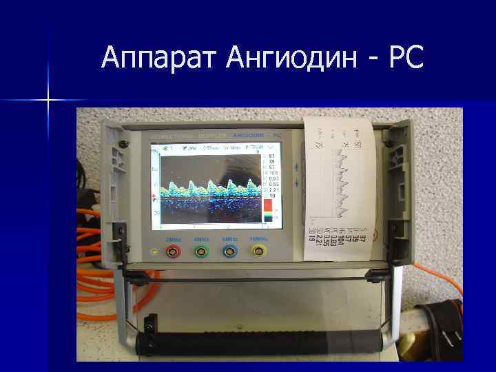 Аппарат Ангиодин - РС 