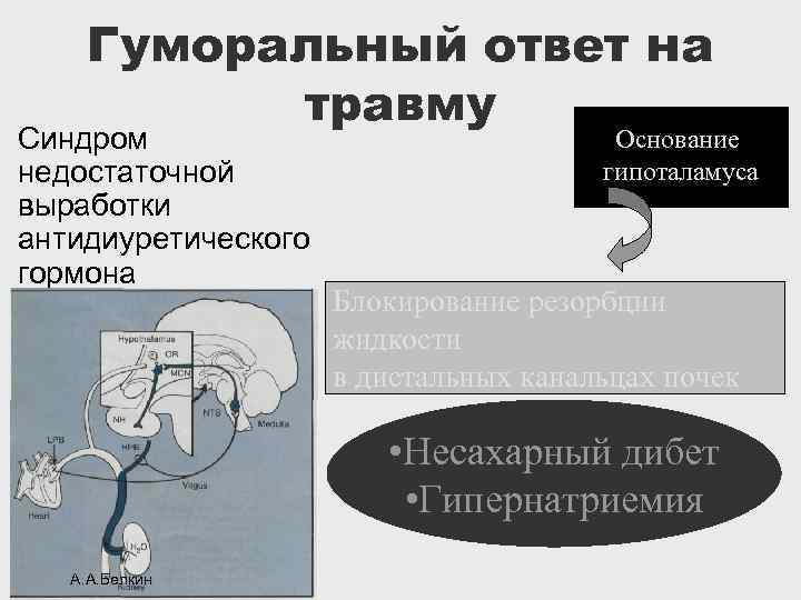 Гуморальный ответ на травму Синдром недостаточной выработки антидиуретического гормона Основание гипоталамуса Блокирование резорбции жидкости