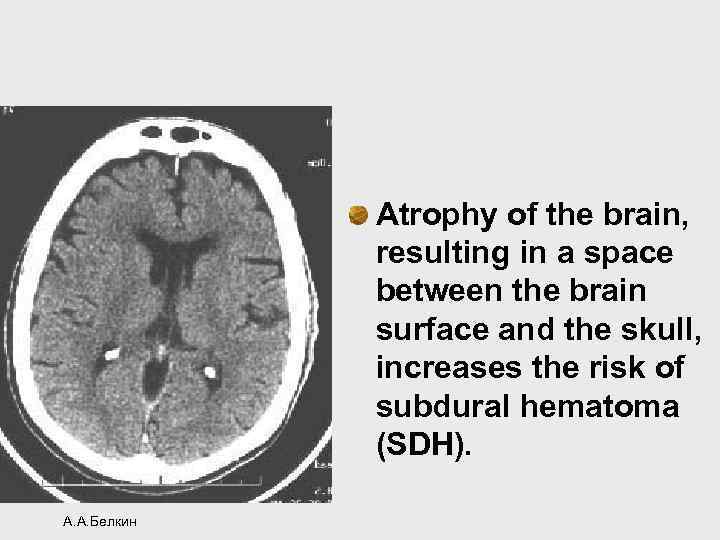 Atrophy of the brain, resulting in a space between the brain surface and the