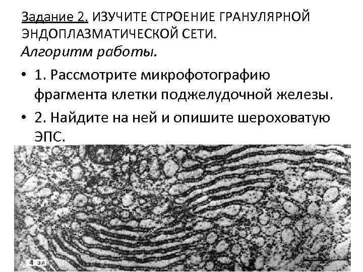 Задание 2. ИЗУЧИТЕ СТРОЕНИЕ ГРАНУЛЯРНОЙ ЭНДОПЛАЗМАТИЧЕСКОЙ СЕТИ. Алгоритм работы. • 1. Рассмотрите микрофотографию фрагмента