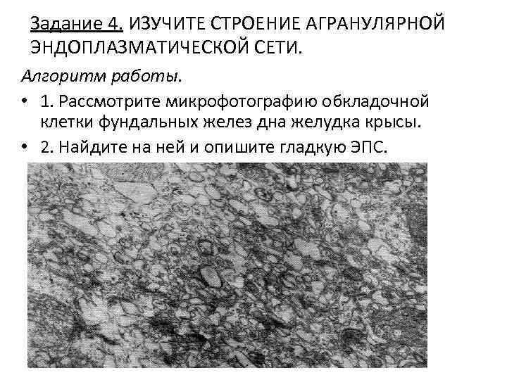 Задание 4. ИЗУЧИТЕ СТРОЕНИЕ АГРАНУЛЯРНОЙ ЭНДОПЛАЗМАТИЧЕСКОЙ СЕТИ. Алгоритм работы. • 1. Рассмотрите микрофотографию обкладочной