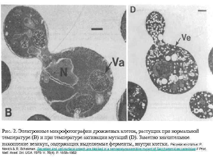 Рис. 2. Электронные микрофотографии дрожжевых клеток, растущих при нормальной температуре (B) и при температуре