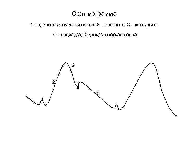 Сфигмограмма 1 - предсистолическая волна; 2 – анакрота; 3 – катакрота; 4 – инцизура;