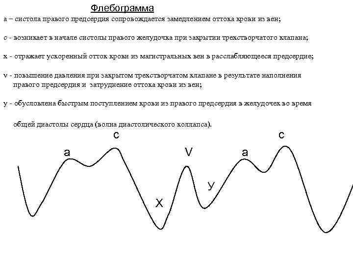  Флебограмма а – систола правого предсердия сопровождается замедлением оттока крови из вен; с
