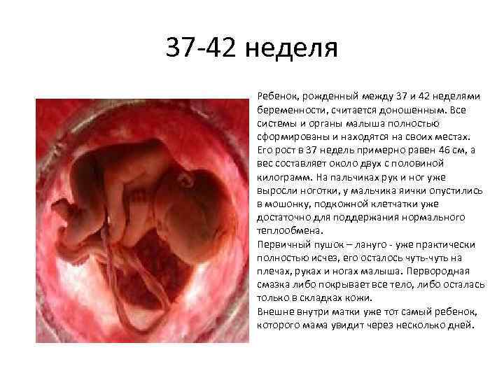 37 -42 неделя Ребенок, рожденный между 37 и 42 неделями беременности, считается доношенным. Все