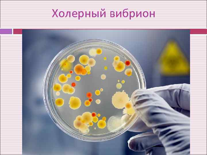 Холерный вибрион 