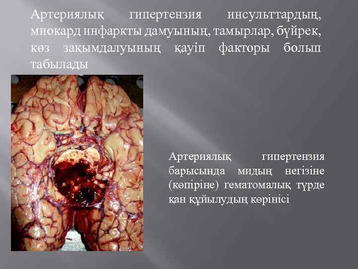 Артериялық гипертензия инсульттардың, миокард инфаркты дамуының, тамырлар, бүйрек, көз зақымдалуының қауіп факторы болып табылады