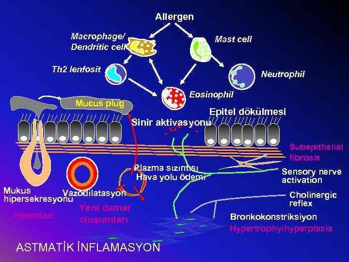 Allergen Macrophage/ Dendritic cell Mast cell Th 2 lenfosit Mucus plug Neutrophil Eosinophil Epitel