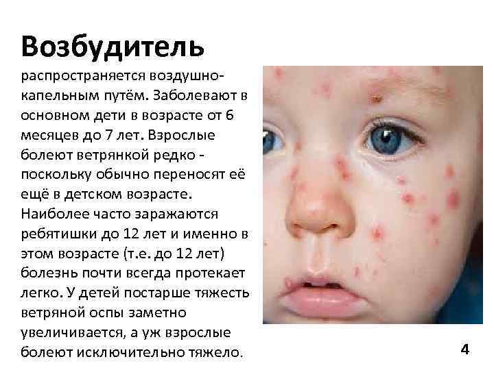 Возбудитель распространяется воздушнокапельным путём. Заболевают в основном дети в возрасте от 6 месяцев до