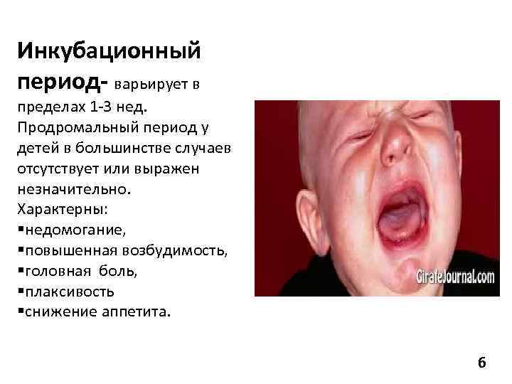 Инкубационный период- варьирует в пределах 1 -3 нед. Продромальный период у детей в большинстве