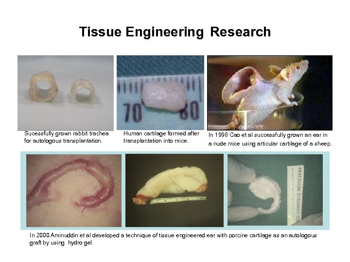 Tissue Engineering Research Sucessfully grown rabbit trachea for autologous transplantation. Human cartilage formed after