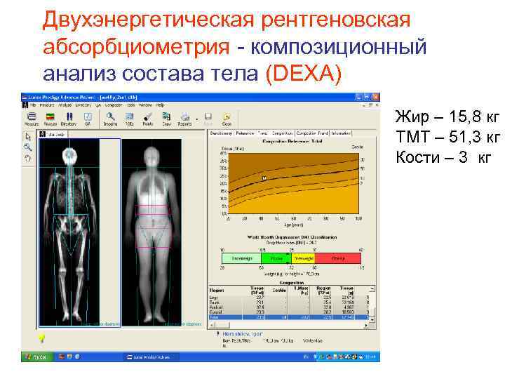 Денситометрия костей в спб адреса. Остеоденситометрия остеопороз. Рентген денситометрия костей. Рентгеновская остеоденситометрия. Рентгеновская денситометрия позвоночника остеопения.