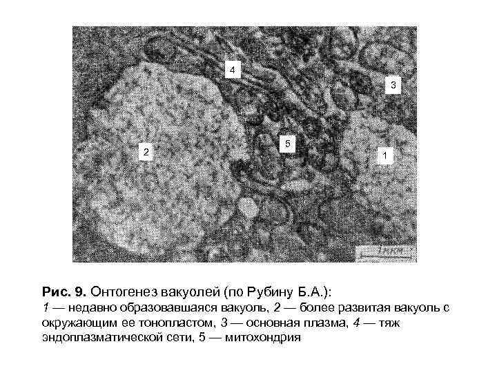 4 3 2 5 1 Рис. 9. Онтогенез вакуолей (по Рубину Б. А. ):
