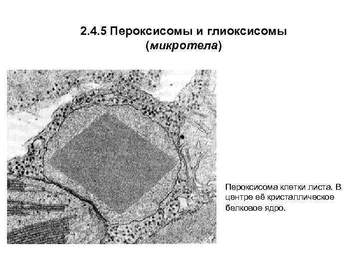 2. 4. 5 Пероксисомы и глиоксисомы (микротела) Пероксисома клетки листа. В центре её кристаллическое