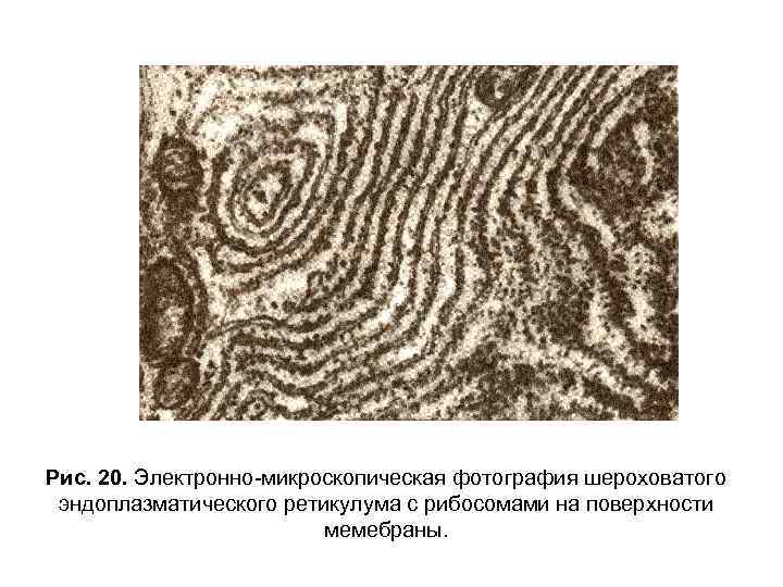 Рис. 20. Электронно-микроскопическая фотография шероховатого эндоплазматического ретикулума с рибосомами на поверхности мемебраны. 
