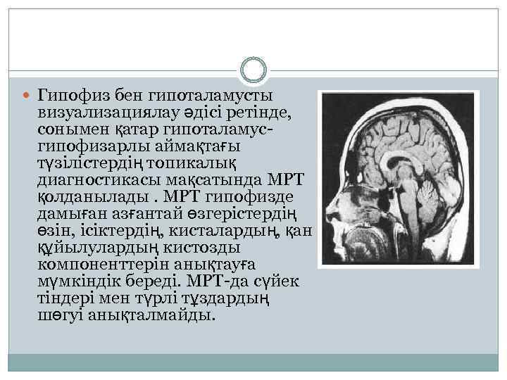  Гипофиз бен гипоталамусты визуализациялау әдісі ретінде, сонымен қатар гипоталамусгипофизарлы аймақтағы түзілістердің топикалық диагностикасы