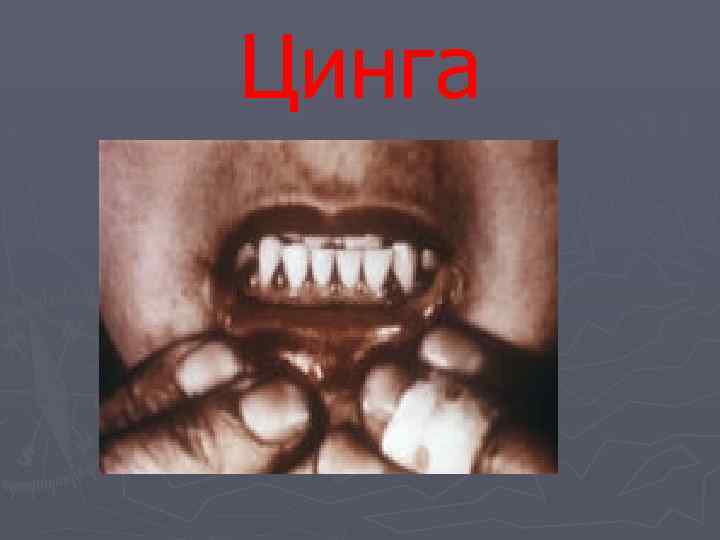Цинга 