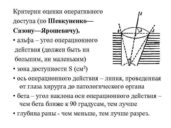 Критерии оценки оперативного доступа (по Шевкуненко— Сазону—Ярошевичу). • альфа – угол операционного действия (должен