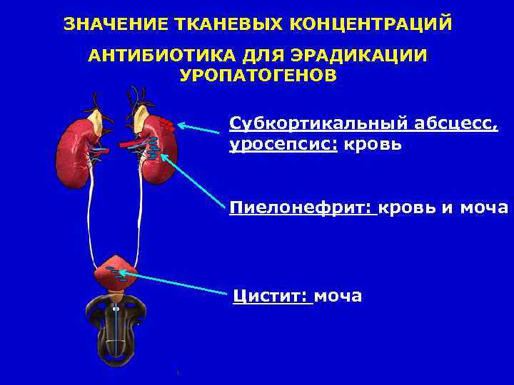 ЗНАЧЕНИЕ ТКАНЕВЫХ КОНЦЕНТРАЦИЙ АНТИБИОТИКА ДЛЯ ЭРАДИКАЦИИ УРОПАТОГЕНОВ Субкортикальный абсцесс, уросепсис: кровь Пиелонефрит: кровь и
