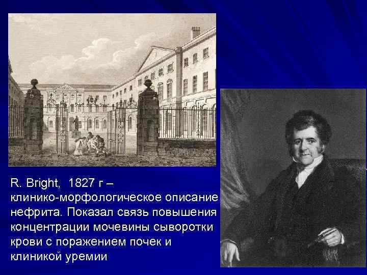 R. Bright, 1827 г – клинико-морфологическое описание нефрита. Показал связь повышения концентрации мочевины сыворотки