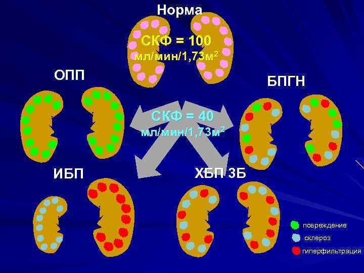 Норма СКФ = 100 мл/мин/1, 73 м 2 ОПП БПГН СКФ = 40 мл/мин/1,