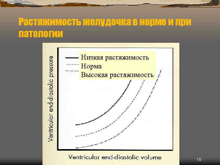 Растяжимость желудочка в норме и при патологии Низкая растяжимость Норма Высокая растяжимость 19 