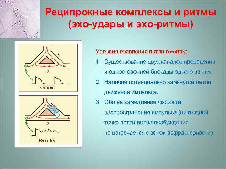 Реципрокные комплексы и ритмы (эхо-удары и эхо-ритмы) Условия появления петли re-entry: 1. Существование двух