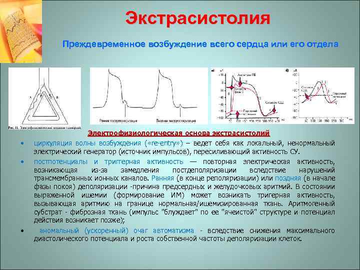 Экстрасистолия Преждевременное возбуждение всего сердца или его отдела • • • Электрофизиологическая основа экстрасистолий