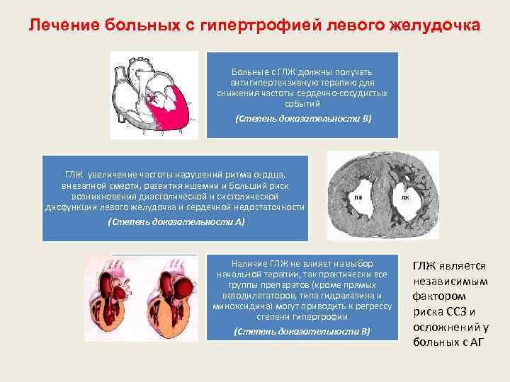 Лечение больных с гипертрофией левого желудочка Больные с ГЛЖ должны получать антигипертензивную терапию для