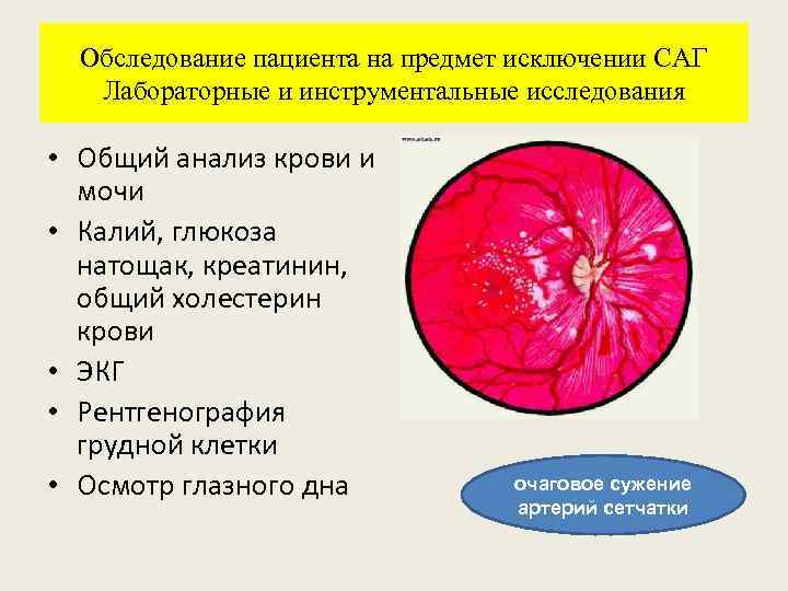Обследование пациента на предмет исключении САГ Лабораторные и инструментальные исследования • Общий анализ крови