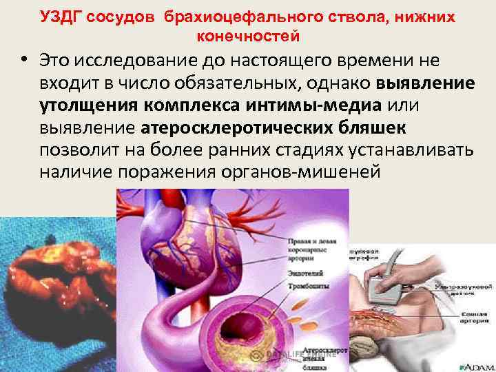 УЗДГ сосудов брахиоцефального ствола, нижних конечностей • Это исследование до настоящего времени не входит
