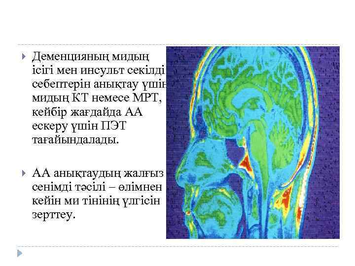  Деменцияның мидың ісігі мен инсульт секілді себептерін анықтау үшін мидың КТ немесе МРТ,