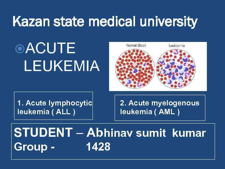 Kazan state medical university ACUTE LEUKEMIA 1. Acute lymphocytic leukemia ( ALL ) 2.